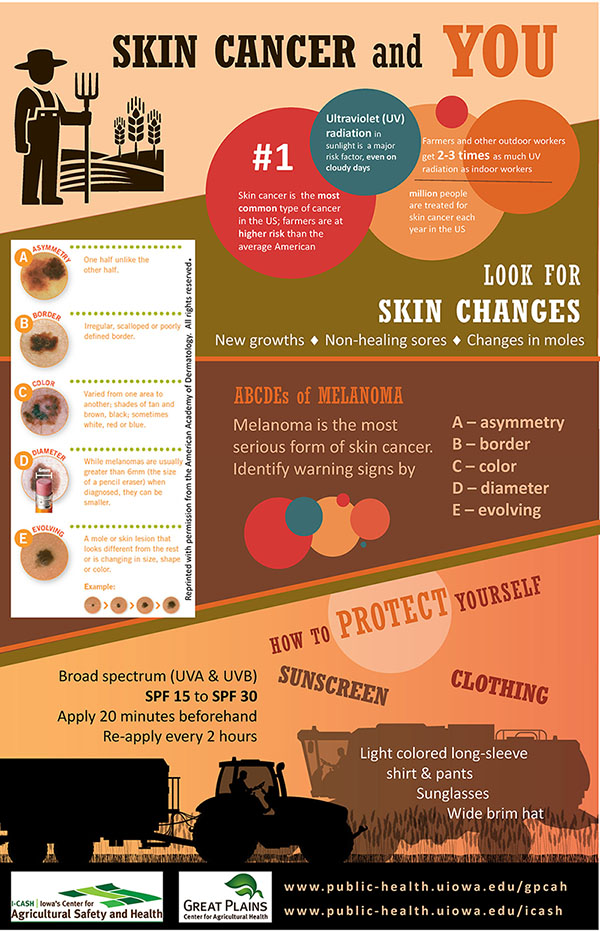 skin cancer prevention infographic
