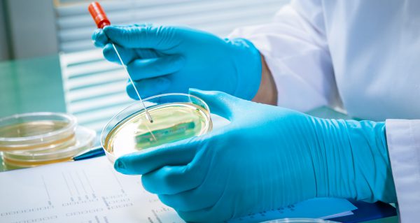 Germs growing on an agar plate in laboratory