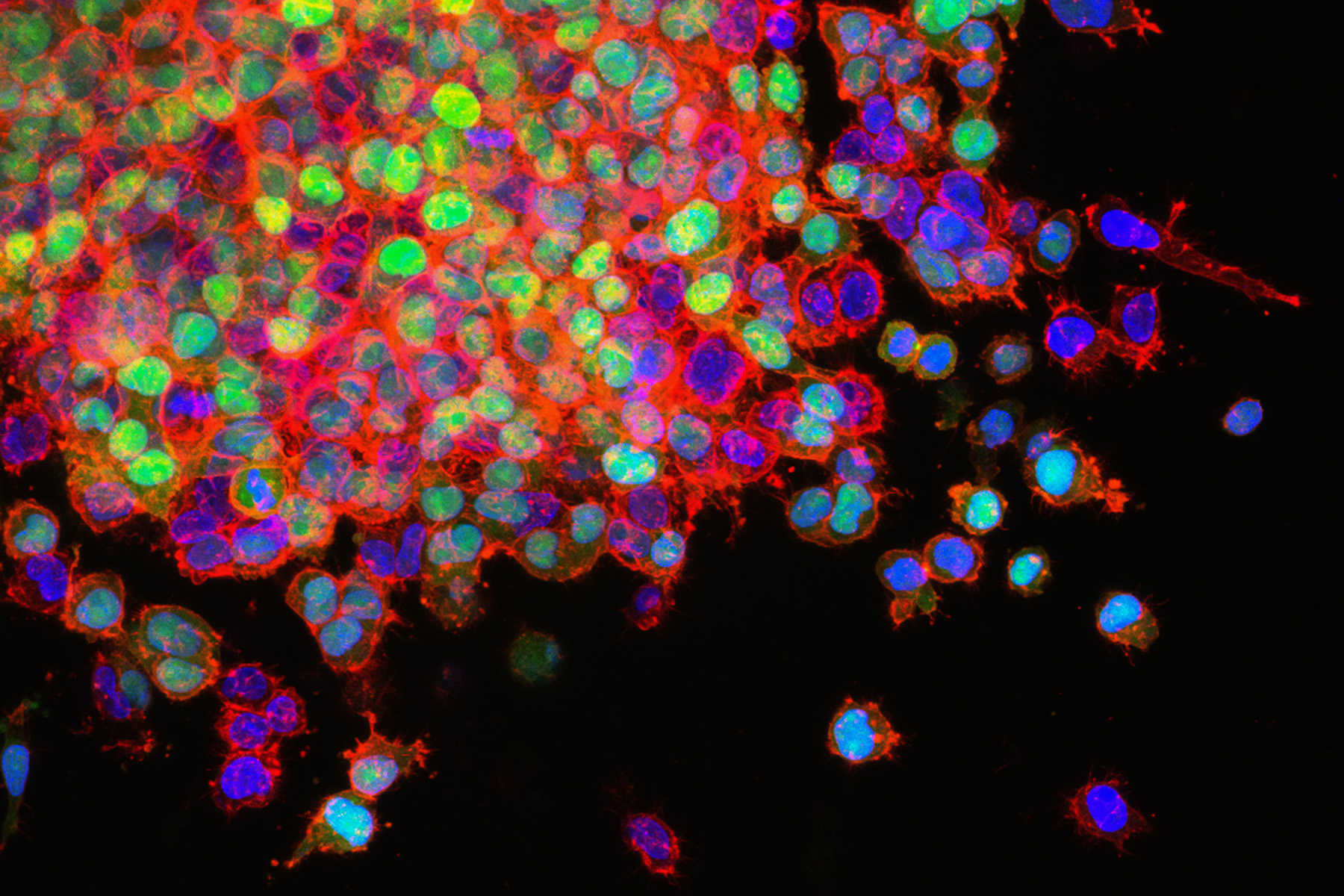 Image of cancer cells from the National Cancer Institute